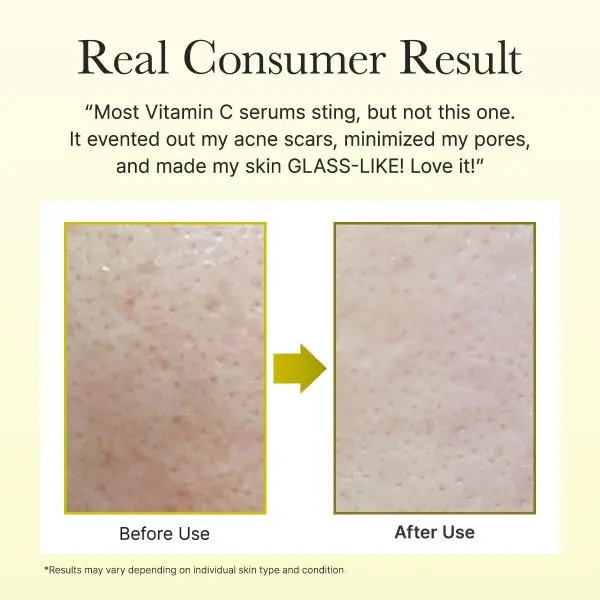 Arencia Vitamin C Booster Shot Serum 30ml By Dream Skin Nepal - Image 5