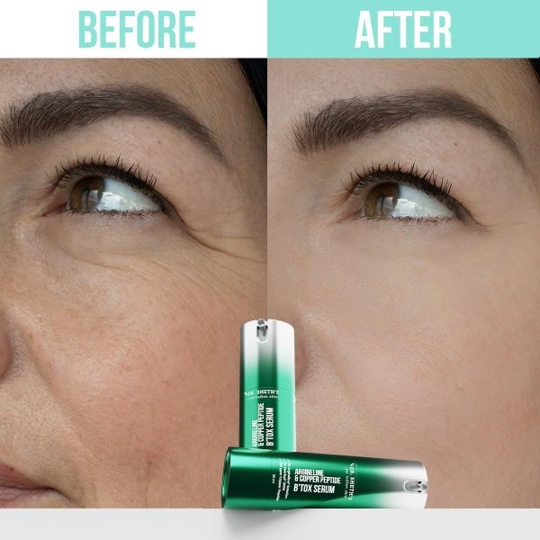 Dr. Sheth's Argireline & Copper Peptide B’TOX Serum-30ml - Image 4