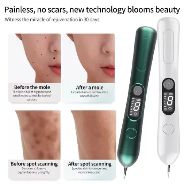 LCD Laser Plasma Mole & Skin Removal Pen Beauty Tool Skin Care Equipment for Salons Skin Clinics - Image 5