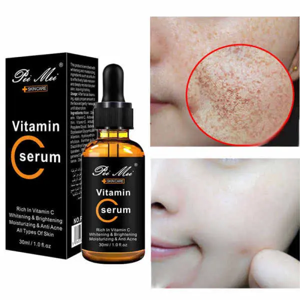 Peimei vitamin c serum 30ml - Image 3