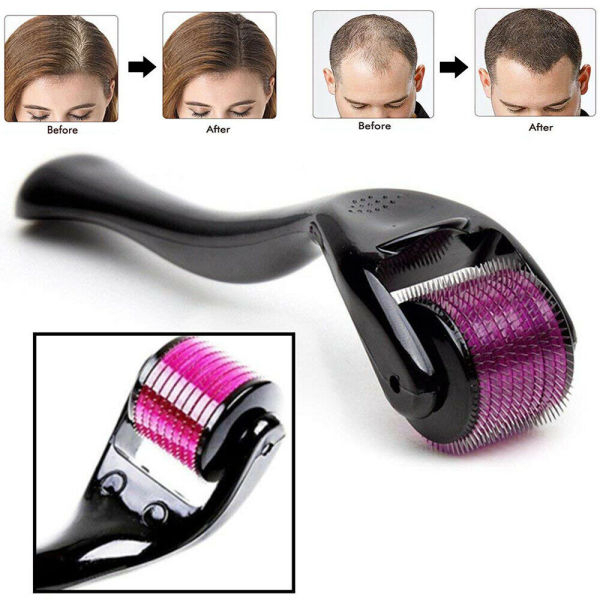 540 Micro Needle Derma Roller Therapy Skin 0.75 Mm - Image 2