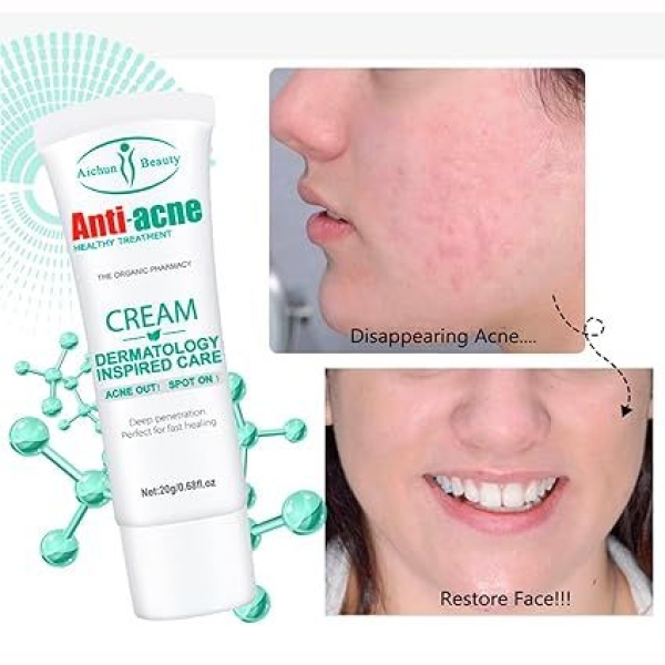 Anti-Acne Cream Treats Pimple Clogged Pores Oil Control Reduces Acne Scars Shrinks Pores 20 G - Image 4