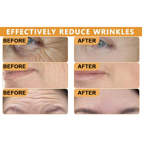 Botox Bee Venom Cream Anti-Aging Face Moisturizer | Wrinkle Removal, Firming & Lifting Cream | Deep Hydration & Skin Recovery | Suitable for All Skin Types (1pc) - Image 5