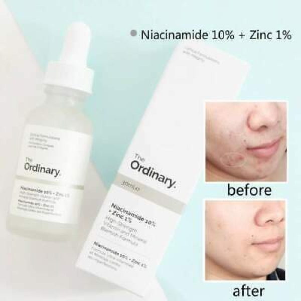 The Ordinary Niacinamide 10% + Zinc 1% (30) - Image 4