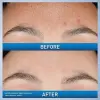237 ML Cleanser And 30 ML Serum