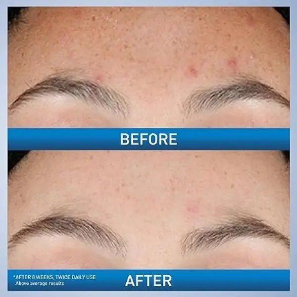 237 ML Cleanser And 30 ML Serum