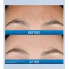 Smoother Skin Texture