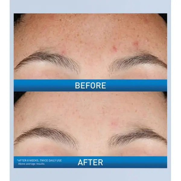 Smoother Skin Texture