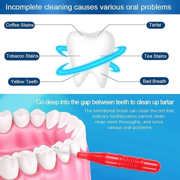 Floss For Braces (Pack of 5)