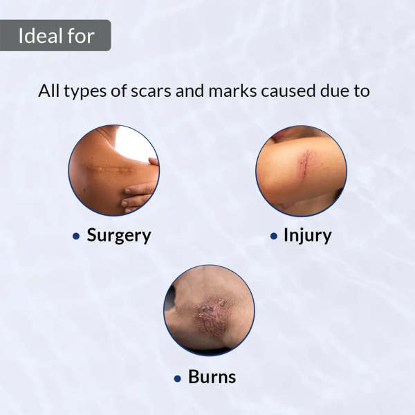 Injury