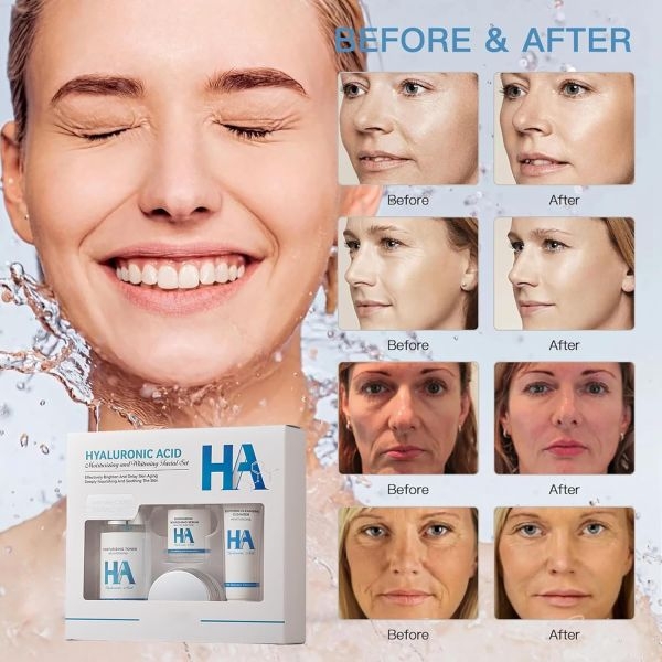 Hyaluronic Acid HA Moisturizing & Hydrating Skin Care 4pcs Set - Image 3