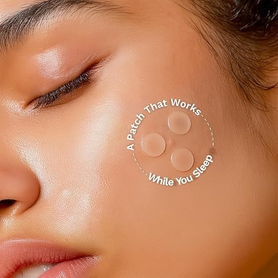Hydrocolloid Acne Relief Patches Reduces Acne, Spots and Blemishes 60 Patches - Image 5
