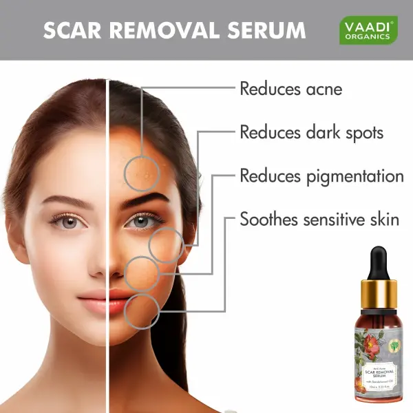 VAADI Scar Removal Serum (10 ml) - Image 3