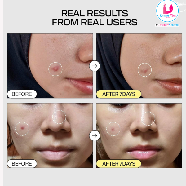 JUMISO Snail Mucin 95 + Peptide Facial Essence [140ml] By Dream Skin Nepal - Image 3