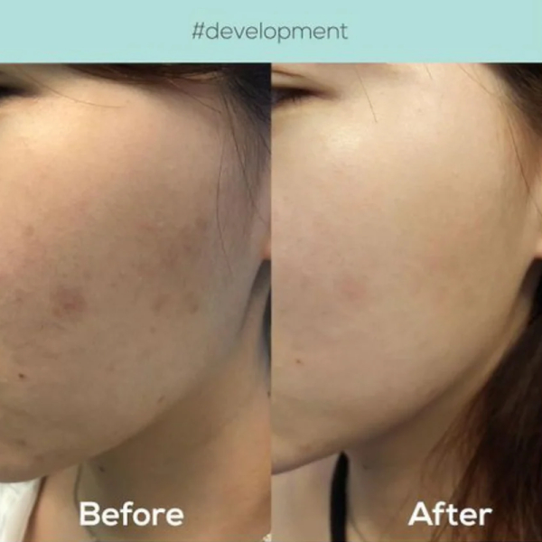 KOJA Axis - Y Dark Spot Correcting Glow Serum 50ml - Image 5