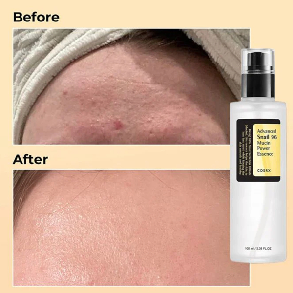 KOJA Cosrx Advanced Snail 96 Mucin Power Essence - Image 3