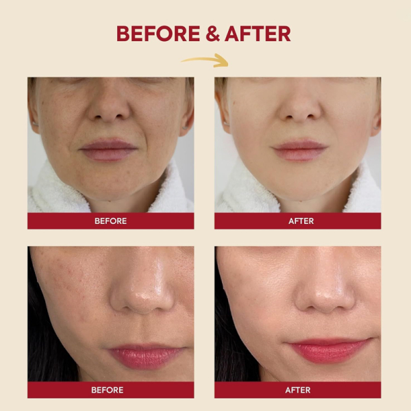 KOJA Essence : Snail Mucin 97% + Rice 100ML - Image 3