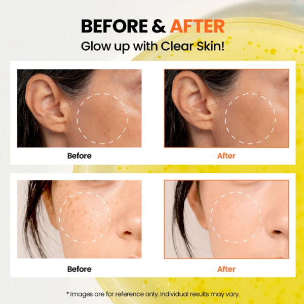 KOJA Glow Serum: Niacinamide 15%+Yuja 30ml - Image 4