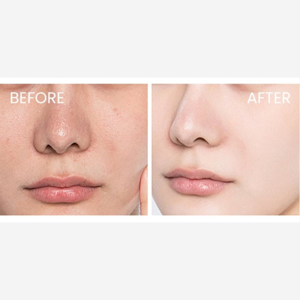 KOJA Skin1OO4 Centella Tea-Trica Relief Ampoule 100ml - Image 3