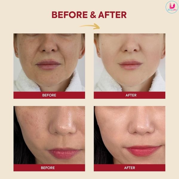 KSECRET SEOUL 1988 Essence : Snail Mucin 97% + Rice [100ml] By Dream Skin Nepal - Image 5