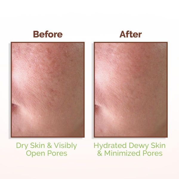Mamaearth Rice Water Dewy Face Toner with Rice Water & 4% Niacinamide for Glass Skin 150ml - Image 4
