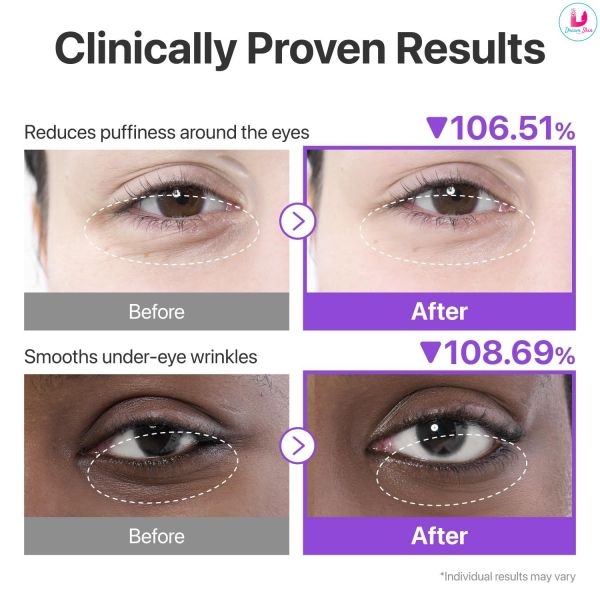 Numbuzin No.9 NAD+ Collagen Under Eye Patches 5 Pairs|10 Patches By Dream Skin Nepal - Image 5