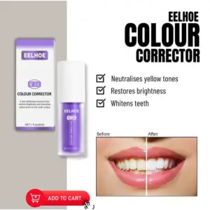 Teeth Whitener 30ml