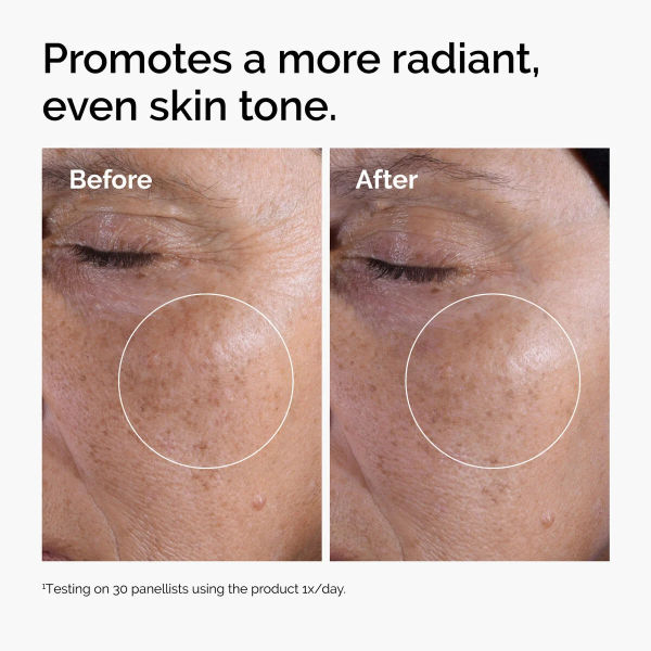 The Ordinary Glycolic Acid 7% Exfoliating Toner And Cotton Round Pads Combo 2 In 1 Skincare Solution For Smooth And Glowing Skin 240 ML - Image 3
