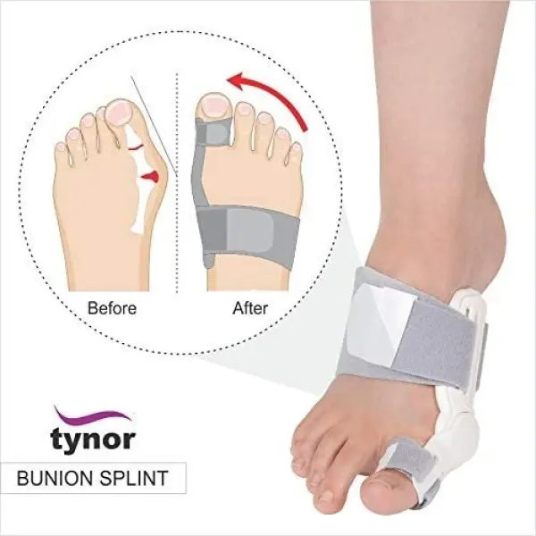 Tynor Bunion Splint Size-Universal - Image 4